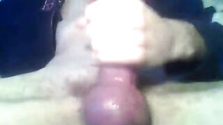 My Subincision